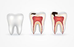 Dental Pulp Treatment Can Help 