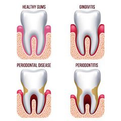 Routine Oral Care and Oral Hygiene
