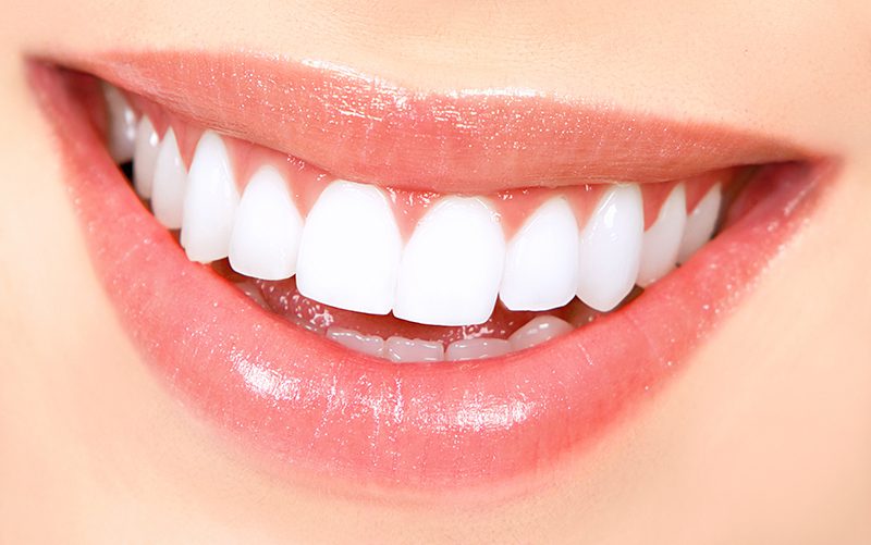 Professional-Teeth-Whitening.jpg