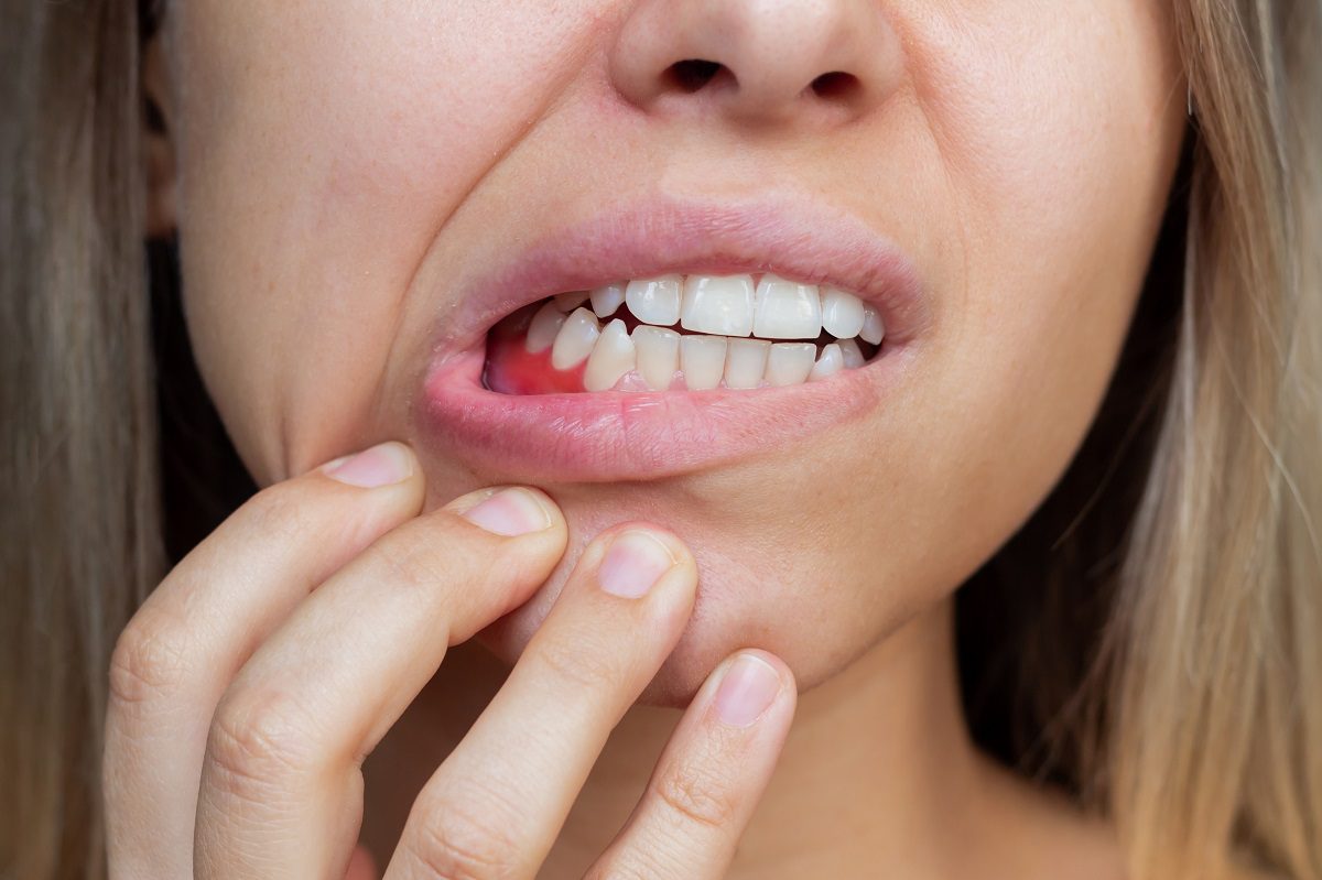 gum-inflammation-closeup-young-woman-showing-bleeding-gums-dentistry-dental-care.jpg