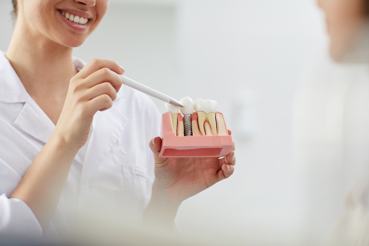 smiling-dentist-explaining-tooth-implantation-1.jpg